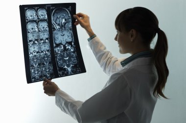 Doktor MRI tarama arıyorsunuz
