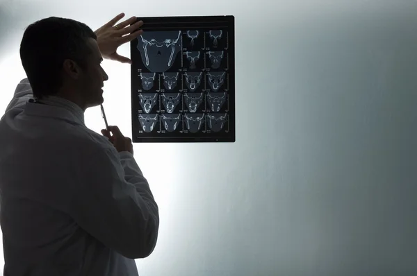 Médico a olhar para a ressonância magnética — Fotografia de Stock