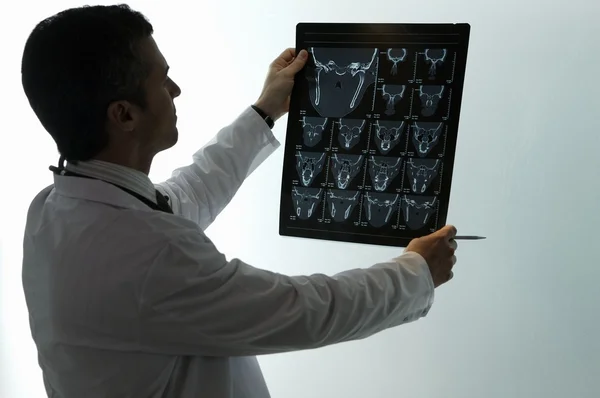 Доктор дивиться на сканування mri — стокове фото