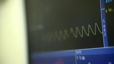 Hastane tiyatrosundaki kalp atış hızı monitörünü kapat. Anestezi cerrahi monitörüne bağlı bir hastanede tıbbi hayati göstergeler monitörü. EKG. Hasta kalp atışı ekranda.