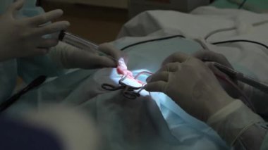 Karmaşık ameliyatlar yapan doktorların elleri. Başla. Profesyonel cerrahlar anestezi altında ameliyat yaparlar. Cerrahlar hastalıkları veya yaraları iyileştirmek için ameliyat yaparlar.