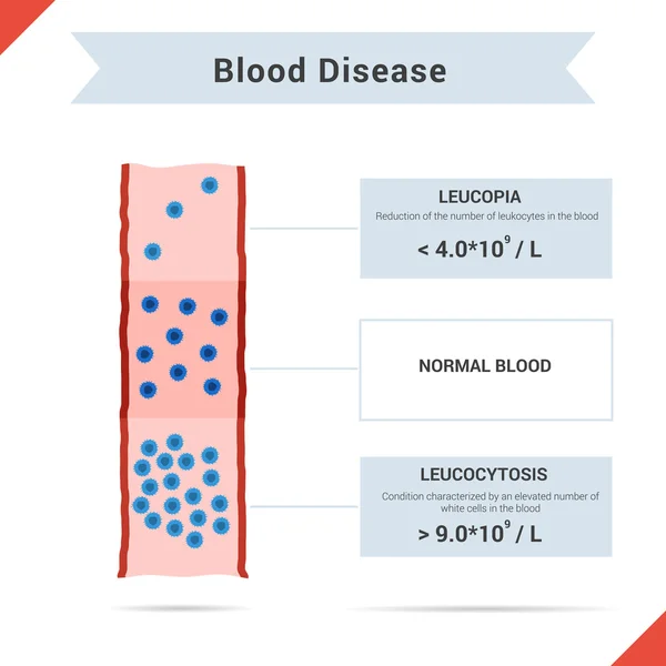 Ikon vér betegség leucocytosis és leukopenia — Stock Vector