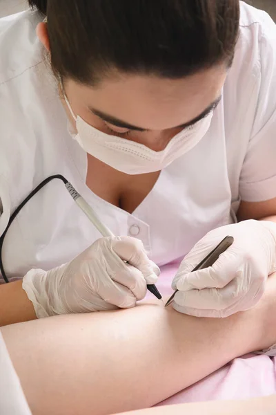 Haarentfernung von Frauenbeinen durch Elektroepilation. Kosmetologie-Eingriff im Schönheitskabinett. — Stockfoto