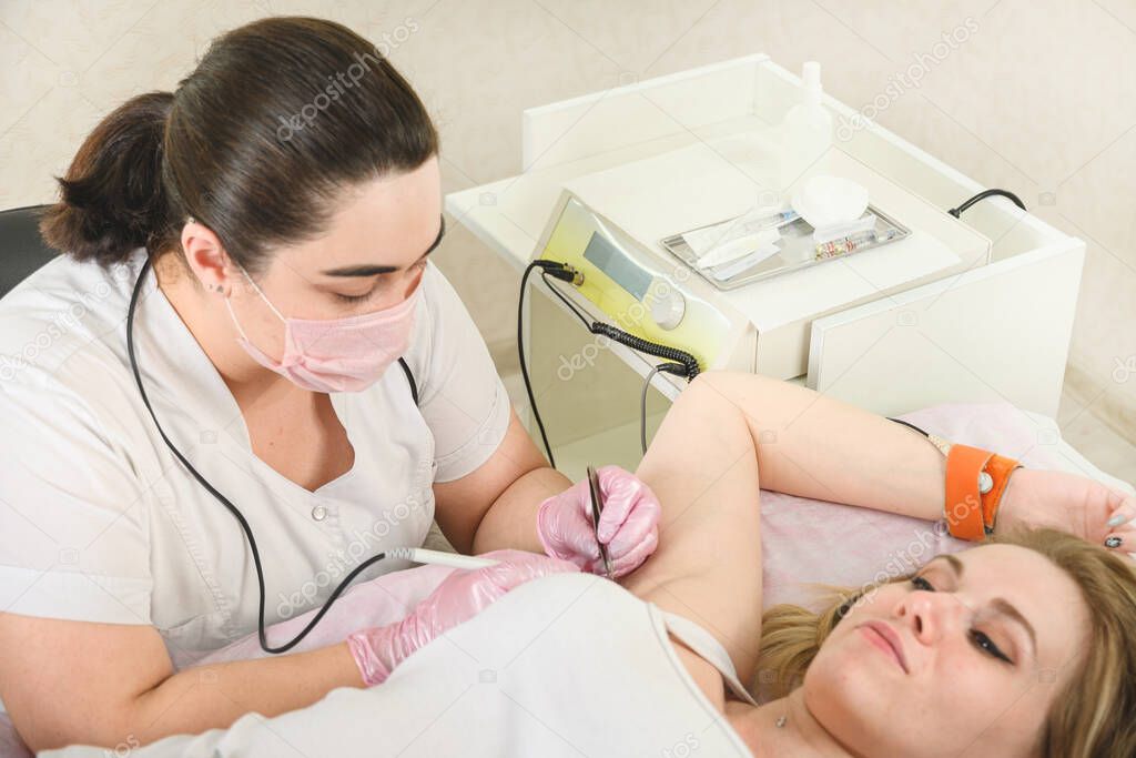 Removal of hair permanently in a womans armpits using electrolysis.