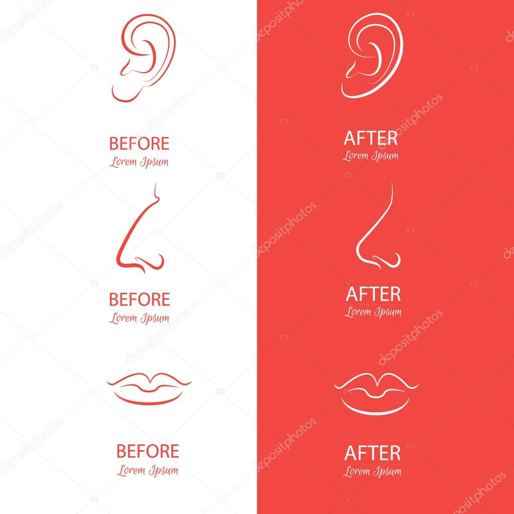 Ears, nose and lips reshaping before and after surgery