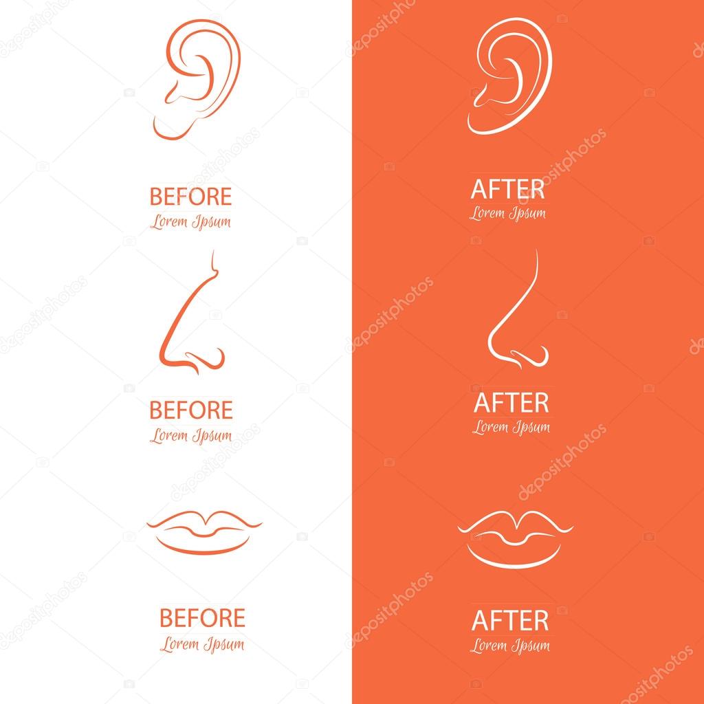 Ears, nose and lips reshaping before and after surgery.