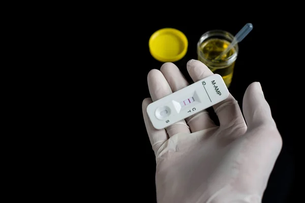 Amfetamin için idrar tespiti