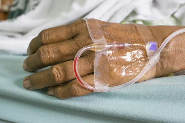 生理食塩水の静脈内投与 (Iv) 点滴で古い女性患者の手 ロイヤリティフリーのストック写真