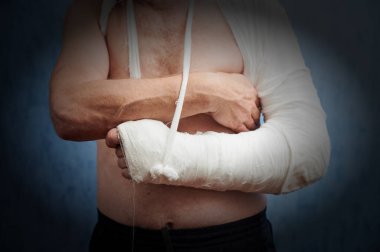 Yaşlı bir adamda omuz yaralanması. Alçı alçı kullanılarak insan motor organlarının hareketsiz hale getirilmesi, elin sürekli anatomik konumunu verir.