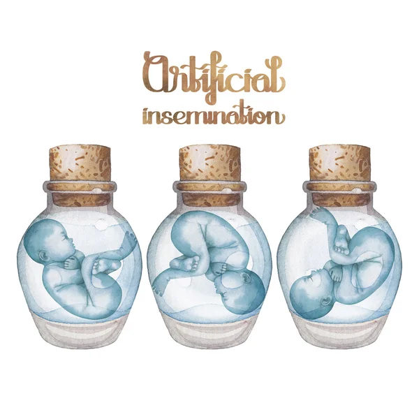 ガラス瓶の中の水彩画の胎児 — ストック写真