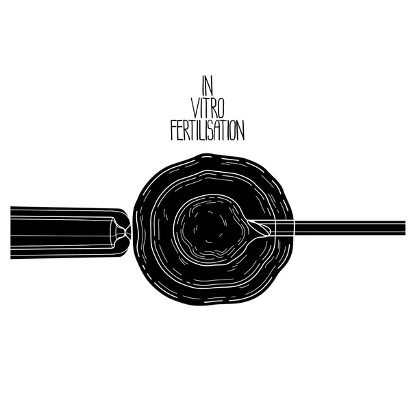 Fertilisation en vitor — Image vectorielle