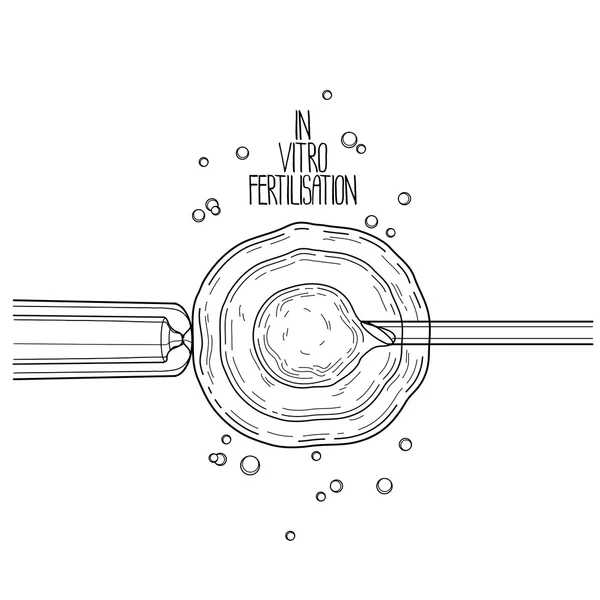 Fertilización in vitro — Archivo Imágenes Vectoriales