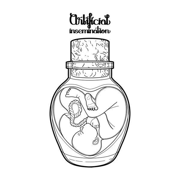 Foetus graphique dans la bouteille en verre — Image vectorielle