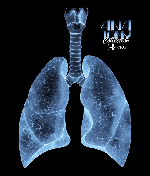 Acuarela Rayos X de los pulmones — Foto de Stock