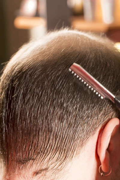 Облысение или потеря волос уход за волосами — стоковое фото