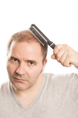 Kellik saç dökülmesi erkek saç kaybı saç bakım