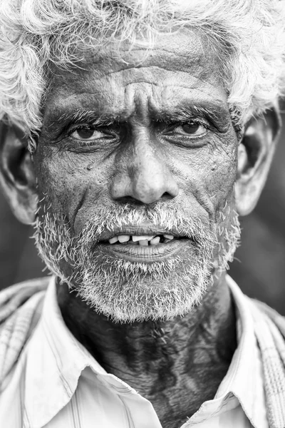 Documentário Editorial. Hospital Pondicherry Jipmer, Índia - 1 de junho de 2014. Documentário completo sobre o paciente e sua família. Editorial Documental . — Fotografia de Stock