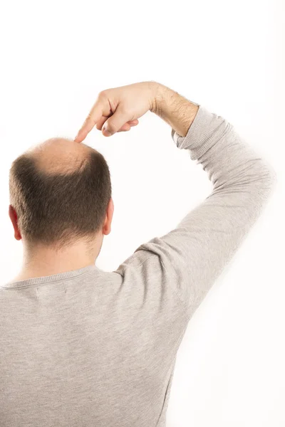 Starszy mężczyzna i problem wypadania włosów — Zdjęcie stockowe