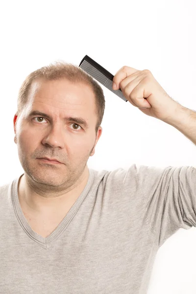 Homme âgé et problème de perte de cheveux — Photo