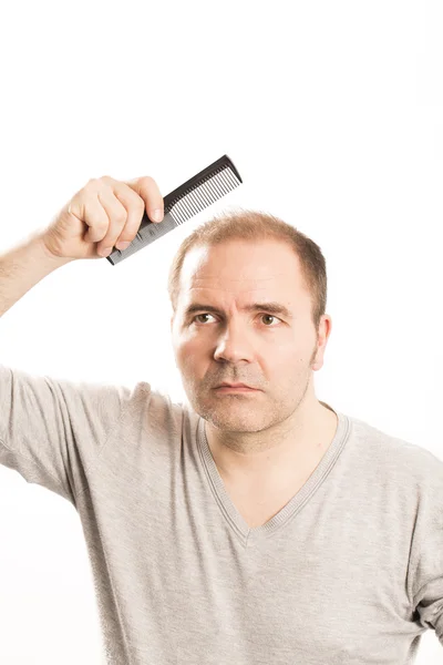 Homem sênior e perda de cabelo questão — Fotografia de Stock