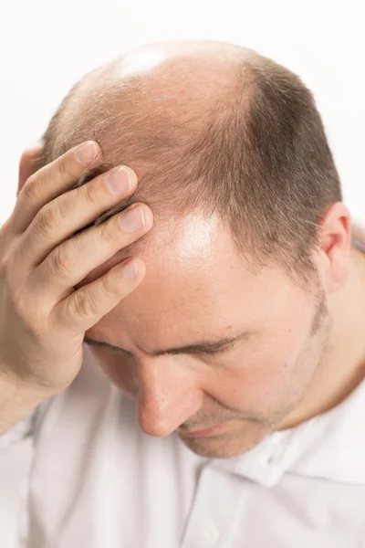 Senior man en haar verlies probleem — Stockfoto