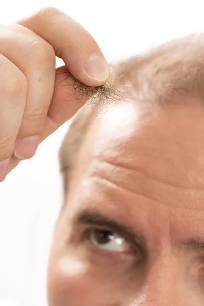 Hombre mayor y problema de pérdida de cabello — Foto de Stock