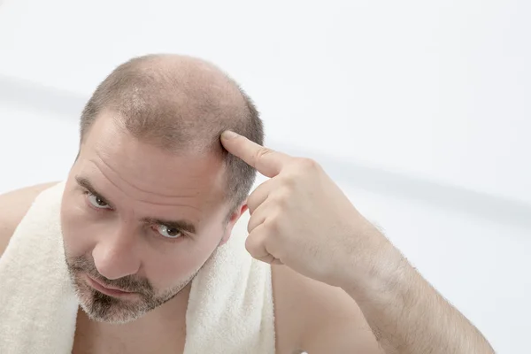 Premature baldness, man, 40s, white background — Stock Photo, Image