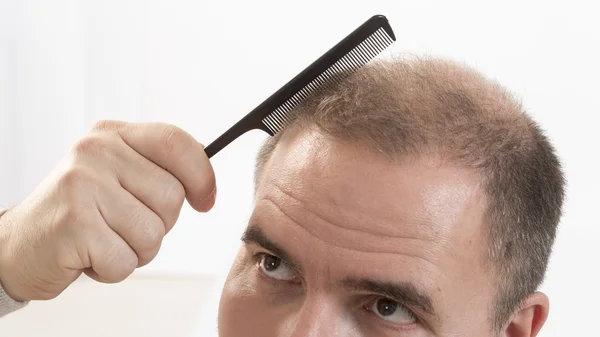 Homem adulto mão segurando pente na cabeça careca — Fotografia de Stock