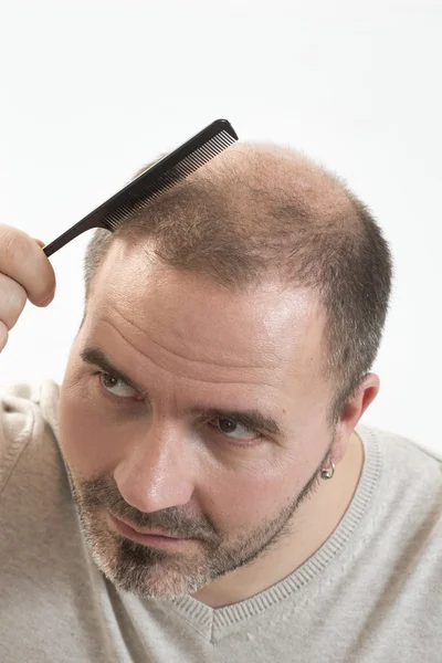 Homem adulto mão segurando pente na cabeça careca — Fotografia de Stock