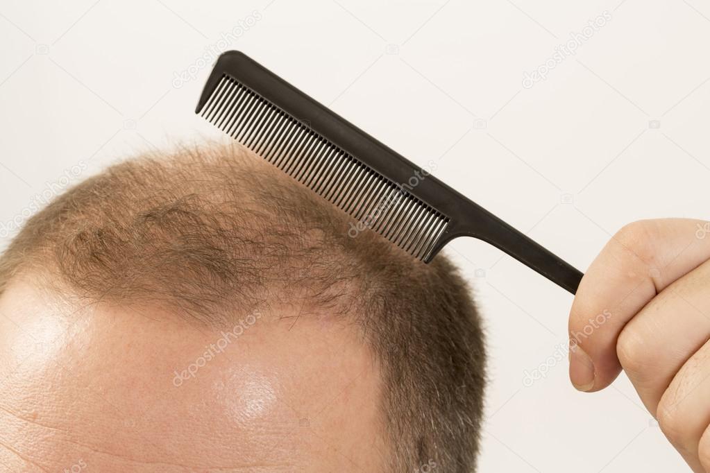 adult man hand holding comb on bald head