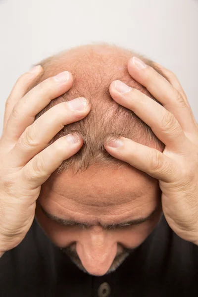 Homme contrôle la perte de cheveux — Photo