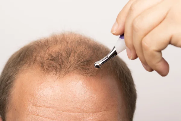 Homme contrôle la perte de cheveux — Photo