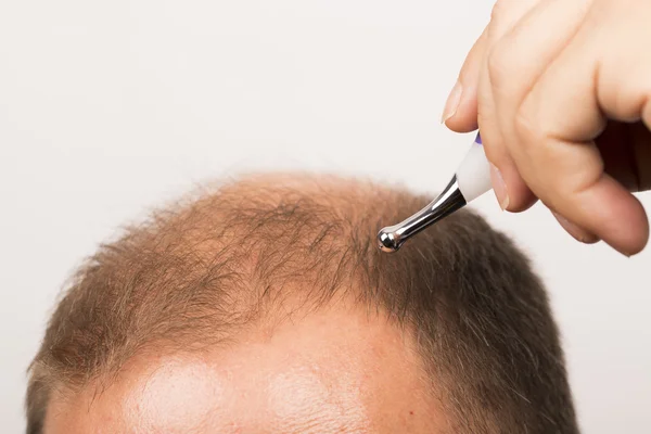 Homme contrôle la perte de cheveux — Photo