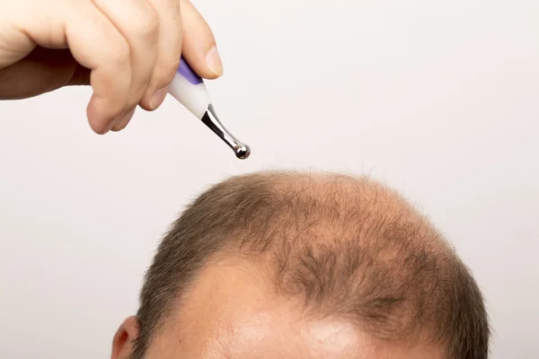 Homme contrôle la perte de cheveux — Photo