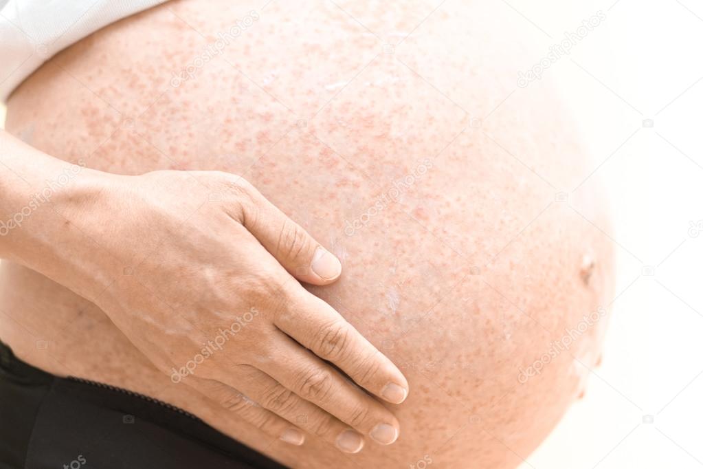 demangeaison ventre femme enceinte demangeaison ventre femme enceinte