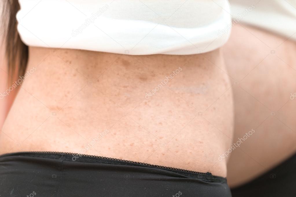 allergi gravid allergi gravid