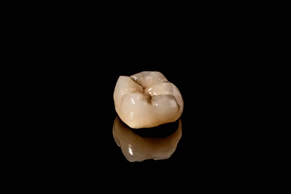 Стоматологический Имплант Восстановление Зубов Зубной Хирург Стоматологическая Лаборатория Стоматология Имплантаты — стоковое фото