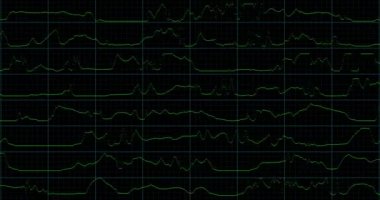 VHS ekran dijital arızası ve gürültü. İzleme kusurlu modu. Renk dinamik gürültü hareketi. Eski film grunge on black background realistik titreşim,