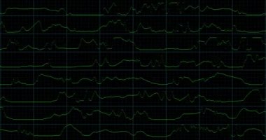 VHS ekran dijital arızası ve gürültü. İzleme kusurlu modu. Renk dinamik gürültü hareketi. Eski film grunge on black background realistik titreşim,