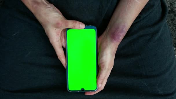 Begrebet vold på sociale medier mod en person. Nomofobi Smartphone bruger Livsstil Psykopatologier. Hænder med blå mærker af en kvinde, der sidder på gulvet. – Stock-video