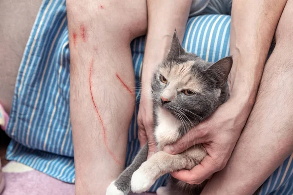 Scratched Wound Man Leg Fresh Wounds Cat Claws Damaged Human — Stock Photo, Image