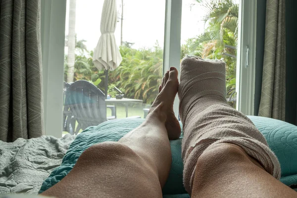 Foot in a cast after the first week of bunion foot surgery during recovery.