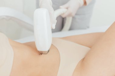 Kadının lazer epilasyonu ve kozmetik prosedürü var.