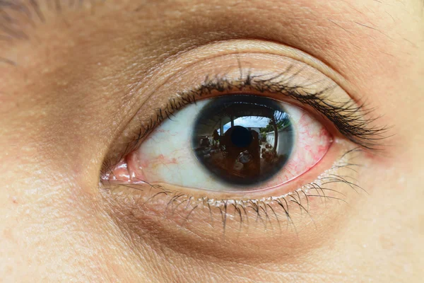 Irritated red blood eye,Close Up — Stock Photo, Image