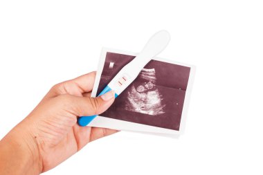 elini tut ultrason ve gebelik testi 