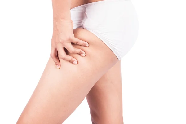 Fat thighs, cellulite of a teenage girl. — Stock Photo, Image