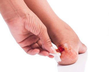 Beyaz badckground topuk, yara