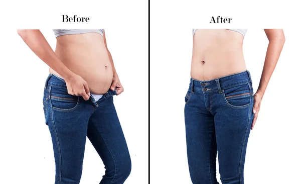 Frauen Körperfett Bauch zwischen vor und nach der Gewichtsabnahme — Stockfoto