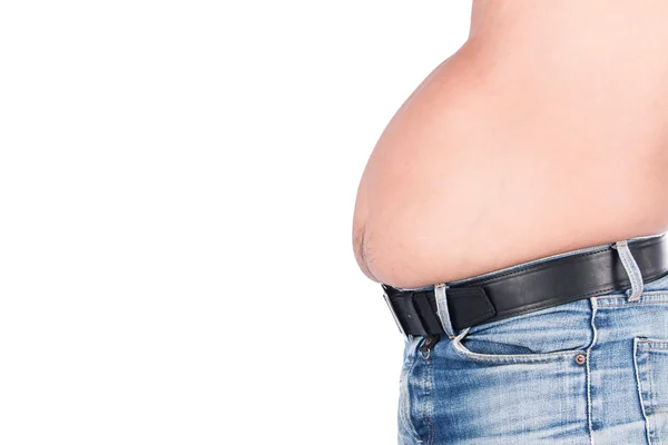 Körper Mann dicken Bauch — Stockfoto