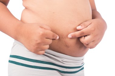 Apandisit ameliyatı sonra küçük işaret iz 